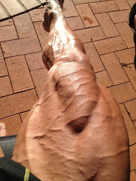 post leg training